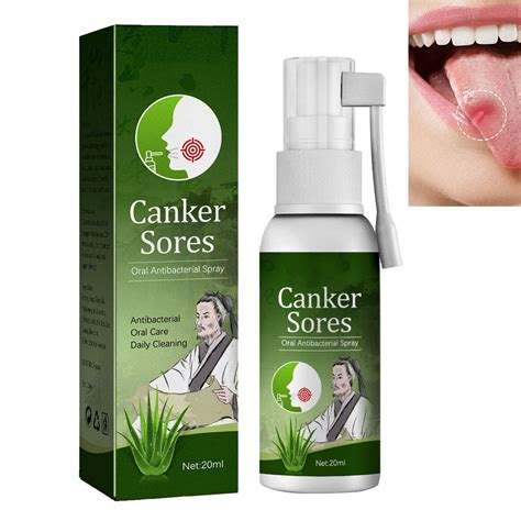 Buy Oral Ulcer Spray,Protect Teeth & Gums,Canker Sore Spray,Oral Ulcer ...