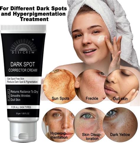 Dark Spot Removal Cream | Dark Spot correction Cream | Flipkart