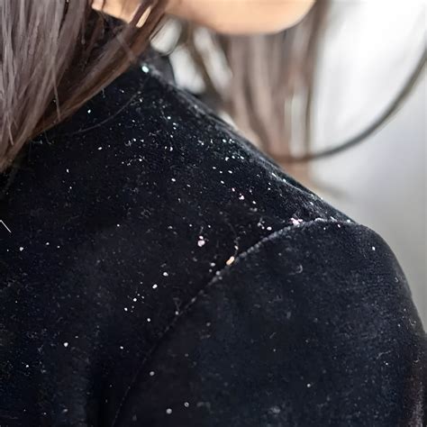 Best Scalp and Hair Care Brand India | Dandruff, Hair Loss Solutions ...