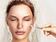 Story Pre Wedding Hair Removal Guide by 4 Tips For Brides Considering Plastic Surgery Arabia Story Pre Wedding Hair Removal Guide