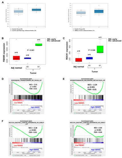 FBXW5 Promotes Tumorigenesis and Metastasis in Gastric Cancer via ...