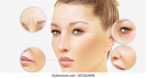 What Botox Looks Like After Years of Use, According to Derms