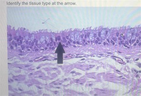 Image result for Ephilehal Tissue Sample
