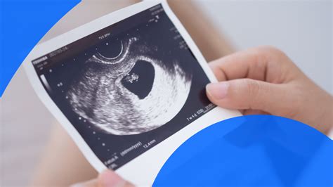 6-Week Pregnancy Ultrasound: Yolk Sac, Fetal Pole, Heartbeat & More