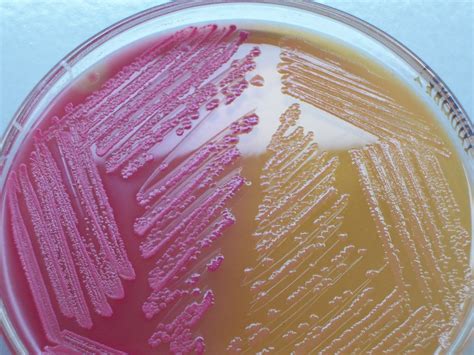 Bacterial Culture Media: classification, types and uses
