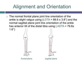 Image result for Normal Leg Alignment
