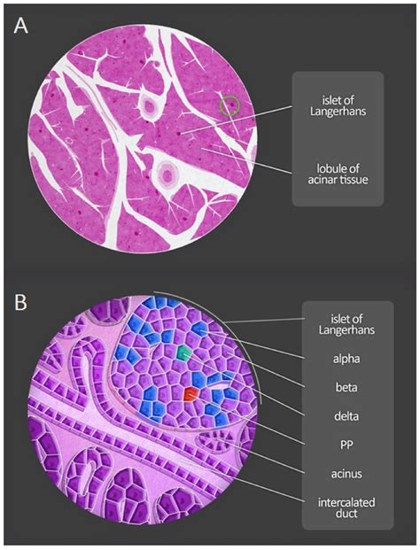 The Pancreas and Known Factors of Acute Pancreatitis