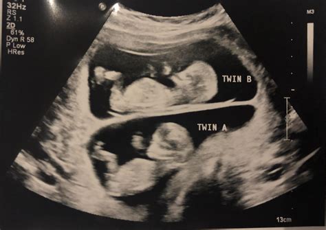 716 best Bunk Beds images on Pholder | Cozy Places, Sims4 and Aww