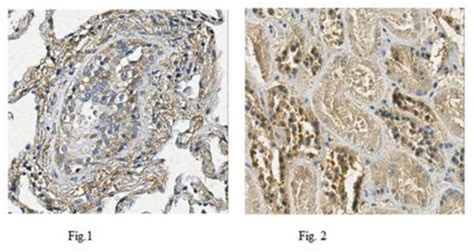 Anti-PTK7 Antibody, clone 4F9 ascites fluid, clone 4F9, from mouse ...