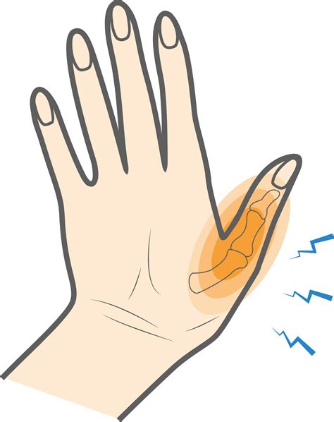 Volleyball Injuries Thumb at Paul Gorman blog