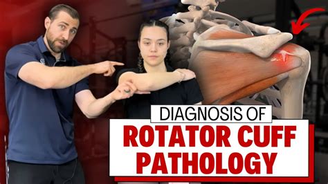 Rotator Cuff Muscles Test 的图像结果