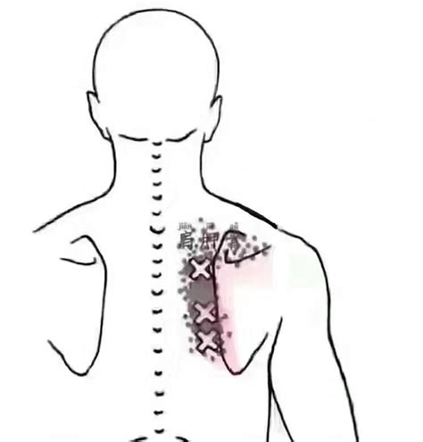 肩胛缝在哪里图,肩胛骨缝,肩胛骨缝的准确位置图_大山谷图库
