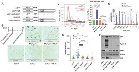 Merkel Cell Polyomavirus Large T Antigen Induces Cellular Senescence ...