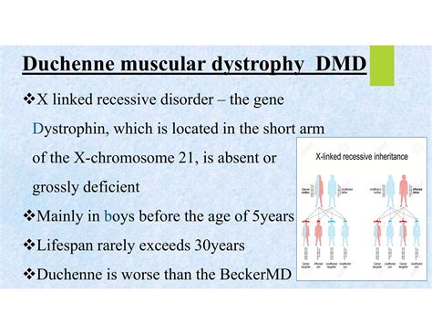 MUSCULAR DYSTROPHY PPT pdf | PDF