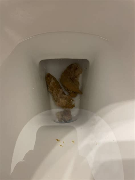 Has anybody had a lot of mucus in their stool (see pics) and received ...