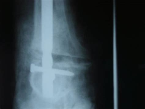 foot & ankle associates