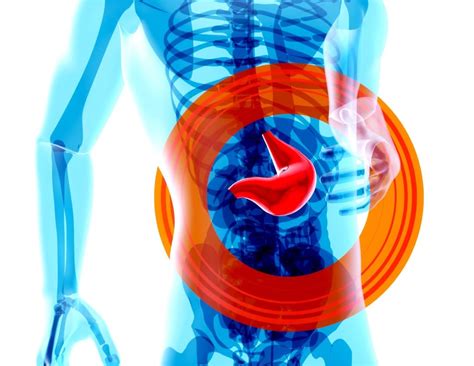 MASLD vs. NAFLD: Understanding Fatty Liver Disease and Your Liver ...