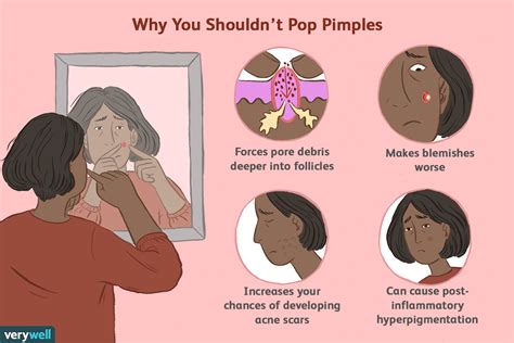 Image result for Worst Exploding Pimple