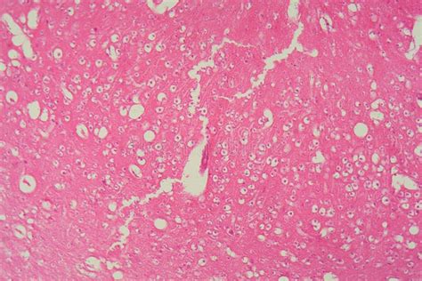 Image result for Brain Under Microscope