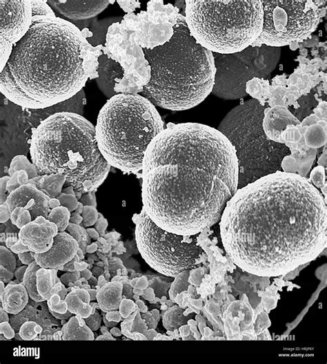 Staphylococcus Aureus Under Microscope 的图像结果