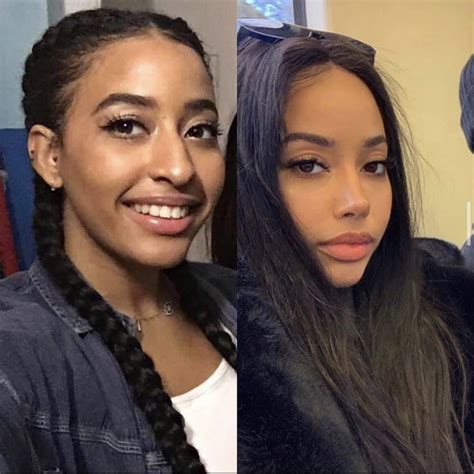 Ethnic Rhinoplasty, Rhinoplasty Surgery, Nose Plastic Surgery, Nose Surgery, Bad Nose Jobs, Nose ...