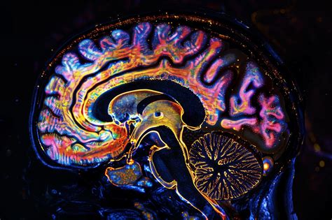 科学网—革命性的光芒:科学家揭示了抑郁症的隐藏化学 - 诸平的博文