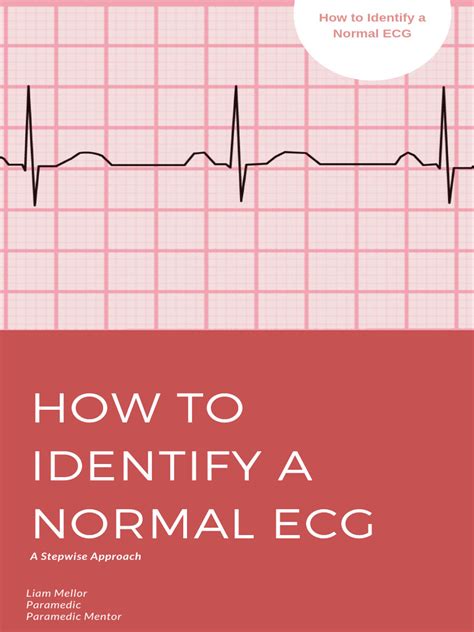 Normal ECG Read Out 的图像结果
