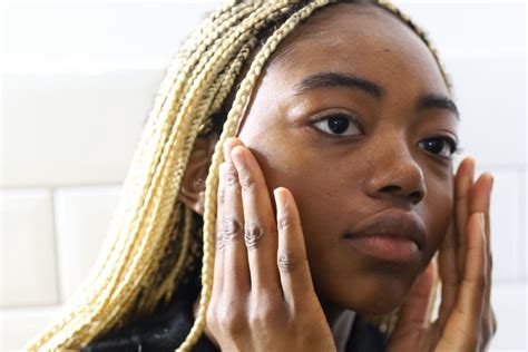 Image result for Sebaceous Filament Extraction