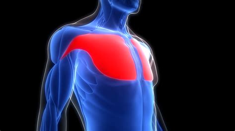 Damaged Chest Muscles