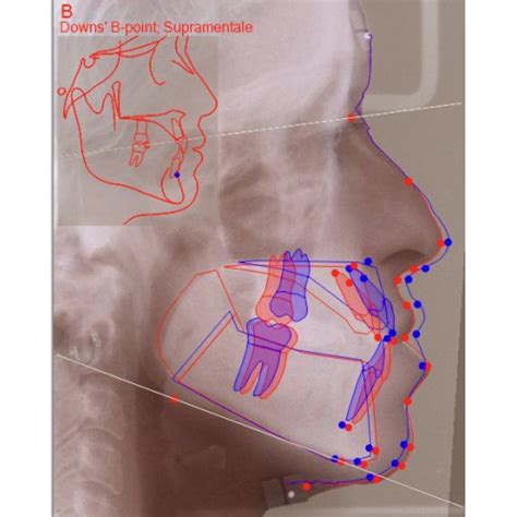 Bluedent India - Rediscover Dentistry