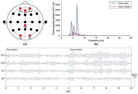 Fully 3D-Printed Dry EEG Electrodes