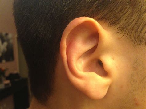 Bildergebnis für early stages of cauliflower ear