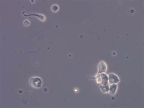 Renal tubular epithelial cells | CellWiki