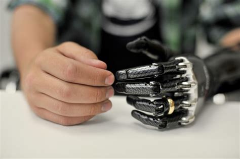 Image result for Bebionic Hand Users