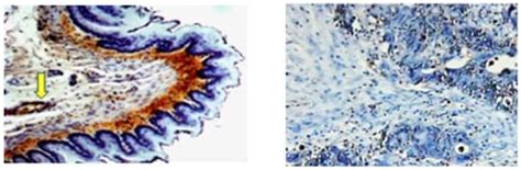 Antioxidants | Special Issue : Redox Proteomics