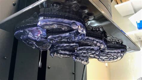 Image result for Inlab Splint Design