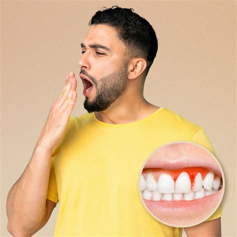 Buy Clove Ultimate Liquid Mouthwash for Bad Breath & Plaque