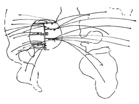 Global Local 的图像结果