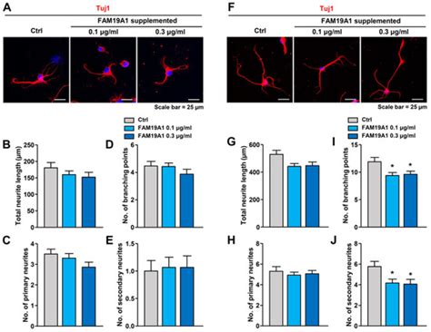Alterations in Dendritic Spine Maturation and Neurite Development ...