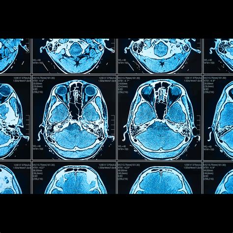Medical Imaging Machine Learning 的图像结果