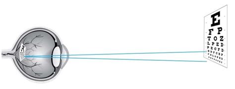 Image result for Eye Visual Acuity