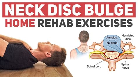 Image result for Bulging Disc Neck Exercises