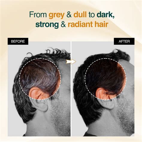 Anti-Greying Rice Water Serum