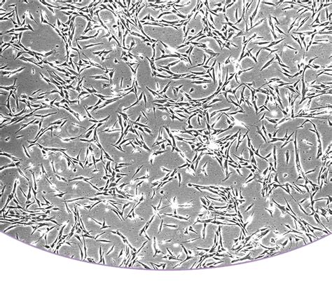 Bone Mineralization Test – AreoVeda