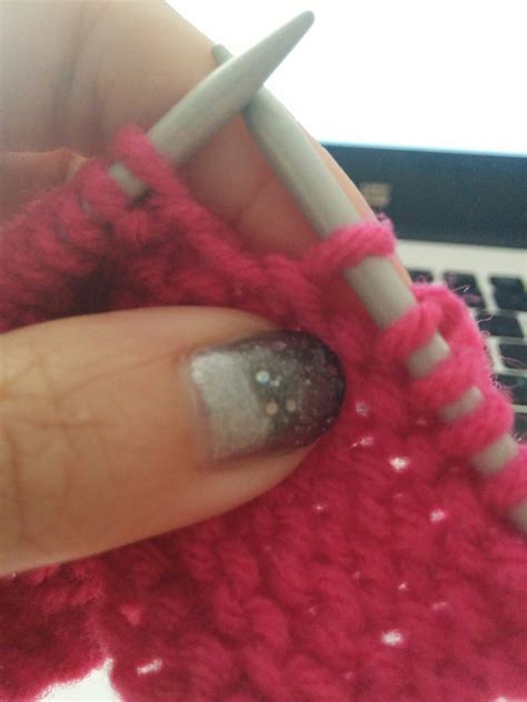 Image result for Surjet Simple Intradermique