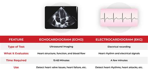 Echocardiogram Vs Ekg Explained By A Cardiologist Myheart What Do My