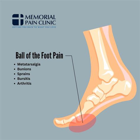 Foot Pain Chart: Common Foot Problems | Memorial Pain Clinic