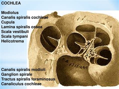 Image result for Modiolus Cochlea