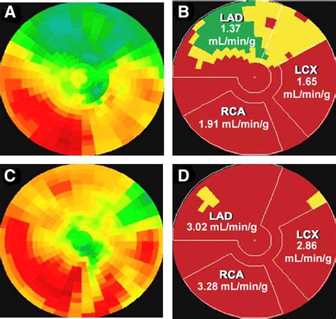 Nuclear Stress Test Side Effects Cardiovascular Chemical Nuclear