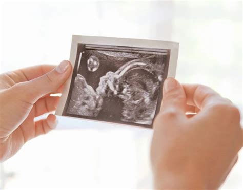 Fetomaternal medicine and High risk pregnancy care - Edappal Hospitals